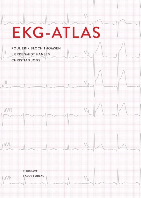 EKG atlas