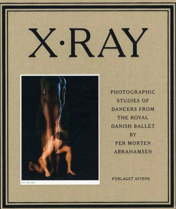 X-RAY